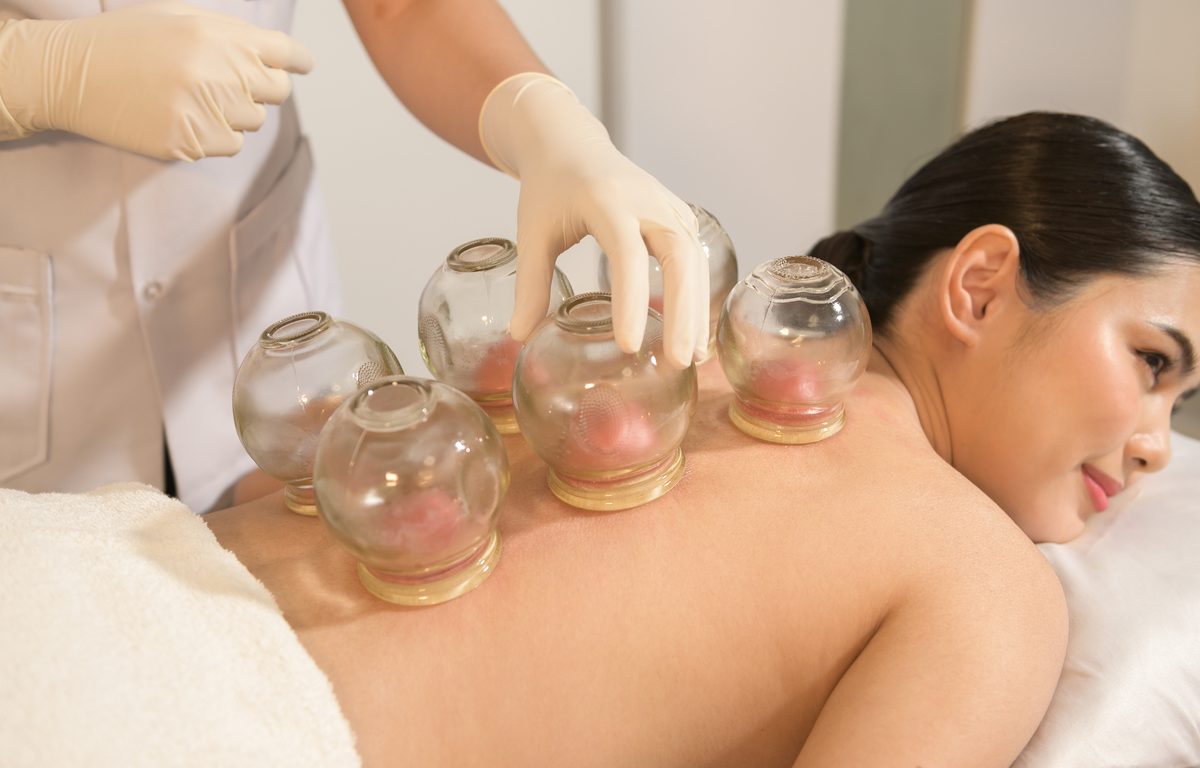 Cupping Therapy